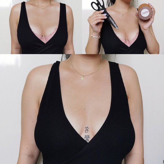 Αυτοκόλλητη κορδέλα για το στήθος, Breast tape